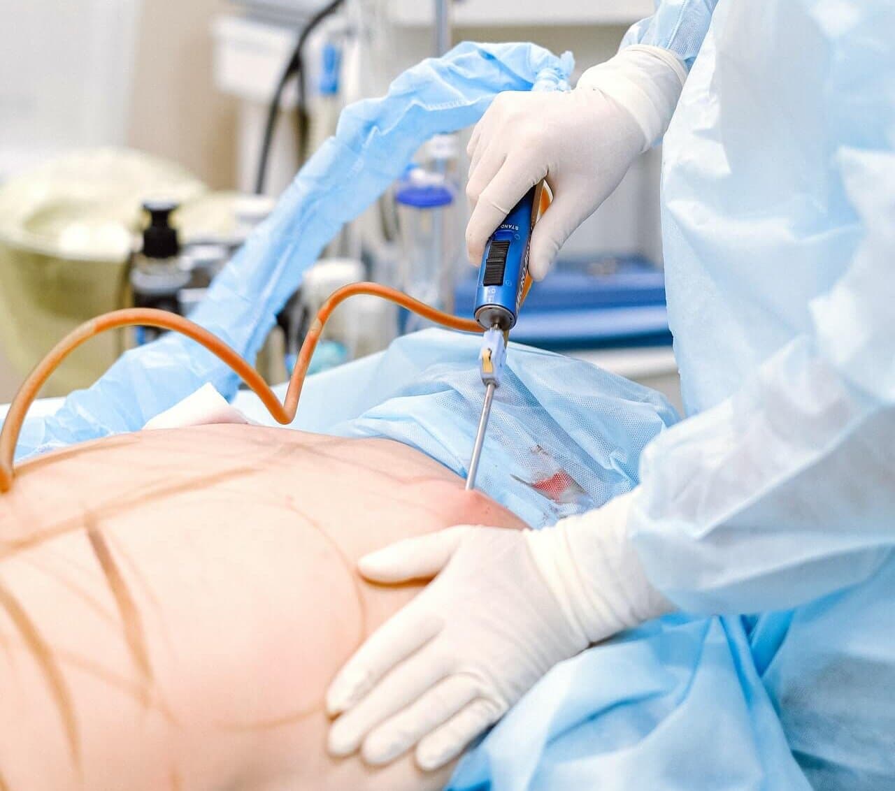 Liposuction Surgery